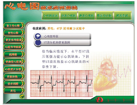 新版心電圖教學軟件 心電圖臨床實例解讀